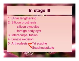 In stage III
1. Ulnar lengthening
2. Silicon prosthesis
      - silicon synovitis
      - foreign body cyst
3. Interacarpal fusion
4. Lunate excision
5. Arthrodesis Tri scaphe
                   Scaphocapitate
 