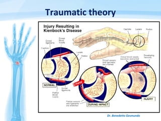 Dr. Benedetto Gesmundo
Traumatic theory
 