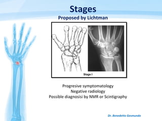 Dr. Benedetto Gesmundo
Stages
Proposed by Lichtman
Progresive symptomatology
Negative radiology
Possible diagnosisi by NMR or Scintigraphy
 