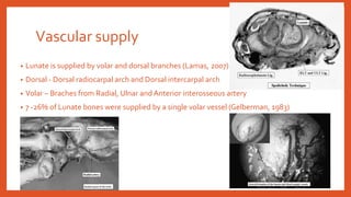 Vascular supply
• Lunate is supplied by volar and dorsal branches (Lamas, 2007)
• Dorsal - Dorsal radiocarpal arch and Dorsal intercarpal arch
• Volar – Braches from Radial, Ulnar and Anterior interosseous artery
• 7 -26% of Lunate bones were supplied by a single volar vessel (Gelberman, 1983)
 