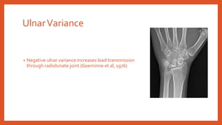 UlnarVariance
• Negative ulnar variance increases load transmission
through radiolunate joint (Goeminne et al, 1976)
 