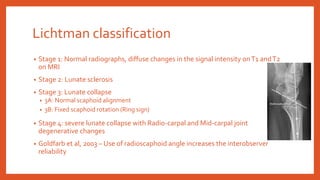 Lichtman classification
• Stage 1: Normal radiographs, diffuse changes in the signal intensity onT1 andT2
on MRI
• Stage 2: Lunate sclerosis
• Stage 3: Lunate collapse
• 3A: Normal scaphoid alignment
• 3B: Fixed scaphoid rotation (Ring sign)
• Stage 4: severe lunate collapse with Radio-carpal and Mid-carpal joint
degenerative changes
• Goldfarb et al, 2003 – Use of radioscaphoid angle increases the interobserver
reliability
 