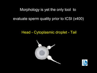 Morphology is yet the only tool toMorphology is yet the only tool to
evaluate sperm quality prior to ICSI (x400)evaluate sperm quality prior to ICSI (x400)
Head - Cytoplasmic droplet - TailHead - Cytoplasmic droplet - Tail
 