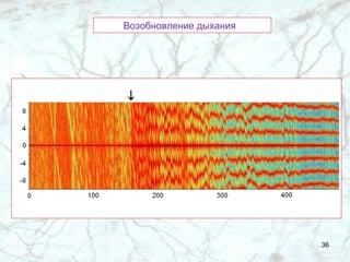 Возобновление дыхания  