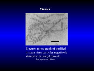 Viruses Electron micrograph of purified tristeza virus particles negatively stained with uranyl formate.  Bar represents 100 nm 