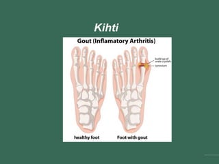 Kihti
 