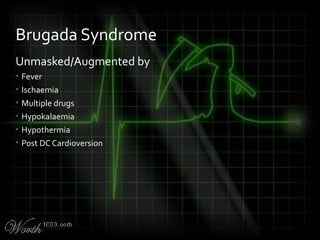 Unmasked/Augmented by
• Fever
• Ischaemia
• Multiple drugs
• Hypokalaemia
• Hypothermia
• Post DC Cardioversion
Brugada Syndrome
 