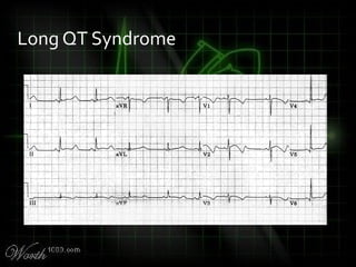 Long QT Syndrome
 
