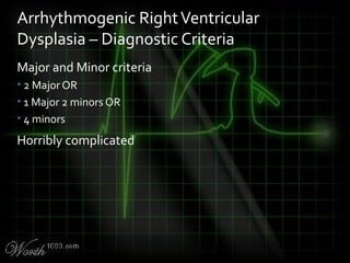 Major and Minor criteria
• 2 Major OR
• 1 Major 2 minors OR
• 4 minors
Horribly complicated
Arrhythmogenic RightVentricular
Dysplasia – Diagnostic Criteria
 