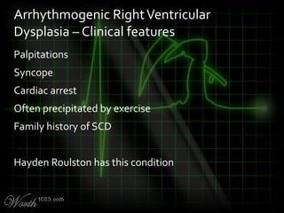 Palpitations
Syncope
Cardiac arrest
Often precipitated by exercise
Family history of SCD
Hayden Roulston has this condition
Arrhythmogenic RightVentricular
Dysplasia – Clinical features
 