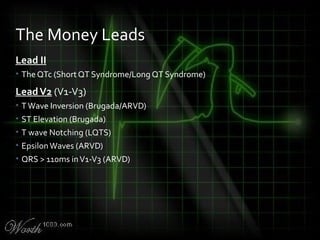 Lead II
• The QTc (Short QT Syndrome/Long QT Syndrome)
LeadV2 (V1-V3)
• TWave Inversion (Brugada/ARVD)
• ST Elevation (Brugada)
• T wave Notching (LQTS)
• EpsilonWaves (ARVD)
• QRS > 110ms inV1-V3 (ARVD)
The Money Leads
 