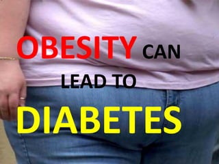 OBESITY CAN
  LEAD TO

DIABETES
 