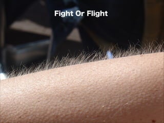 Fight Or Flight
 