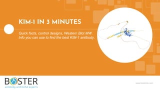 www.bosterbio.com
KIM-1 IN 3 MINUTES
Quick facts, control designs, Western Blot MW.
Info you can use to find the best KIM-1 antibody.
 