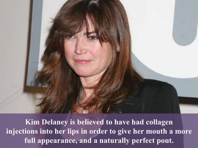 Kim Delaney Plastic Surgery PPT