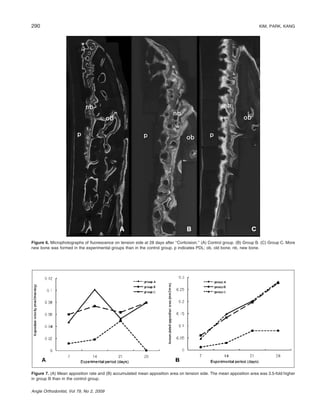 290

KIM, PARK, KANG

Figure 6. Microphotographs of ﬂuorescence on tension side at 28 days after ‘‘Corticision.’’ (A) Control group. (B) Group B. (C) Group C. More
new bone was formed in the experimental groups than in the control group. p indicates PDL; ob, old bone; nb, new bone.

Figure 7. (A) Mean apposition rate and (B) accumulated mean apposition area on tension side. The mean apposition area was 3.5-fold higher
in group B than in the control group.
Angle Orthodontist, Vol 79, No 2, 2009

 