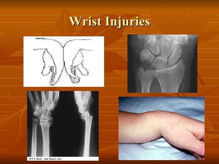 Kin 188 Wrist And Hand Evaluation And Injuries