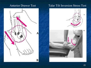 Anterior Drawer Test Talar Tilt Inversion Stress Test 