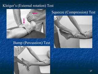 Kleiger’s (External rotation) Test Squeeze (Compression) Test Bump (Percussion) Test 