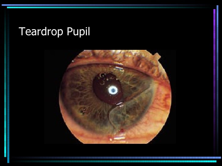 Kin 191 B Face And Eye Anatomy, Evaluation And Injuries