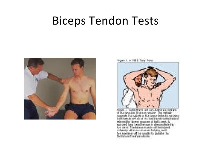 Distal Biceps Tendon Test : Distal biceps rupture: Evaluation and ...