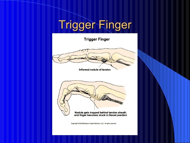 Kin 191 B – Wrist, Hand And Finger Evaluation And Pathologies
