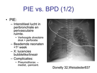 PIE vs. BPD (1/2) PIE:  Interstitieel lucht in peribronchiale en perivasculaire ruimte. Verhoogde alveolaire druk > perforatie Beademde neonaten <1 e  week X: lucencies bubblelike/lineair  Complicaties: Pneumothorax. –medist, -pericard. Donelly 32,Weissleder837 