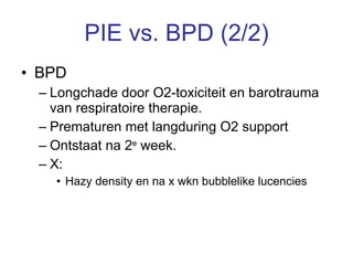 PIE vs. BPD (2/2) BPD Longchade door O2-toxiciteit en barotrauma van respiratoire therapie.  Prematuren met langduring O2 support Ontstaat na 2 e  week. X: Hazy density en na x wkn bubblelike lucencies 