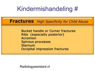 Kindermishandeling # Radiologyassistant.nl 