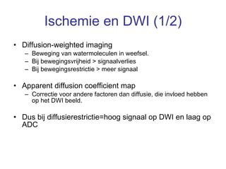 Ischemie en DWI (1/2) Diffusion-weighted imaging Beweging van watermoleculen in weefsel. Bij bewegingsvrijheid > signaalverlies Bij bewegingsrestrictie > meer signaal  Apparent diffusion coefficient map Correctie voor andere factoren dan diffusie, die invloed hebben op het DWI beeld. Dus bij diffusierestrictie=hoog signaal op DWI en laag op ADC 
