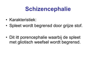 Schizencephalie Karakteristiek: Spleet wordt begrensd door grijze stof.  Dit itt porencephalie waarbij de spleet met gliotisch weefsel wordt begrensd. 