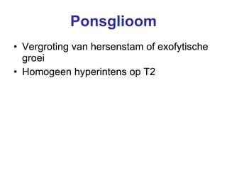Ponsglioom Vergroting van hersenstam of exofytische groei Homogeen hyperintens op T2 
