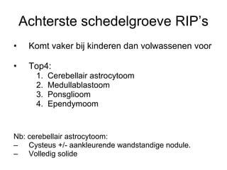 Achterste schedelgroeve RIP’s Komt vaker bij kinderen dan volwassenen voor Top4: Cerebellair astrocytoom Medullablastoom Ponsglioom Ependymoom Nb: cerebellair astrocytoom:  Cysteus +/- aankleurende wandstandige nodule.  Volledig solide 
