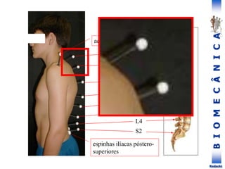 B
I
O
M
E
C
Â
N
I
C
A
Rodacki
T7
T4
T10
T12
L2
L4
S2
C7
acrômios
espinhas ilíacas póstero-
superiores
 