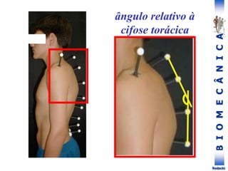 B
I
O
M
E
C
Â
N
I
C
A
Rodacki
ângulo relativo à
cifose torácica
 