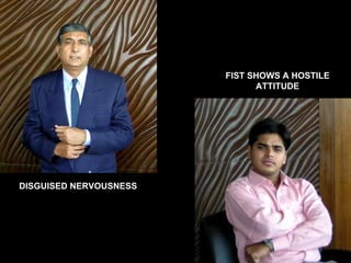 DISGUISED   NERVOUSNESS FIST SHOWS A HOSTILE ATTITUDE 