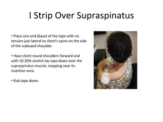 I Strip Over Supraspinatus Place one end (base) of the tape with no tension just lateral to client’s spine on the side of the subluxed shoulder. Have client round shoulders forward and with 10-20% stretch lay tape down over the supraspinatus muscle, stopping near its insertion area. Rub tape down. 