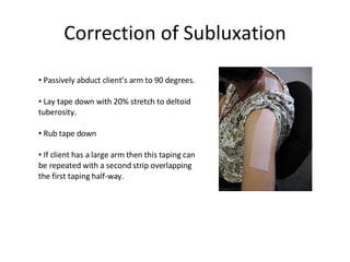 Correction of Subluxation Passively abduct client’s arm to 90 degrees. Lay tape down with 20% stretch to deltoid tuberosity. Rub tape down  If client has a large arm then this taping can be repeated with a second strip overlapping the first taping half-way. 