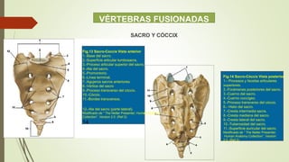 VÉRTEBRAS FUSIONADAS
SACRO Y CÓCCIX
Fig.13 Sacro-Coccix Vista anterior
1.-Base del sacro.
2.-Superficie articular lumbosacra.
3.-Proceso articular superior del sacro.
4.-Ala del sacro.
5.-Promontorio.
6.-Línea terminal.
7.-Agujeros sacros anteriores.
8.-Vértice del sacro
9.-Proceso transverso del cóccix.
10.-Cóccix.
11.-Bordes transversos.
12.-Ala del sacro (parte lateral).
Modificado de ” The Netter Presenter; Human Anatomy
Collection”. Version 2.0. (Ref.3)
14
Fig.14 Sacro-Cóccix Vista posterior
1.- Procesos y facetas articulares
superiores.
2.-Forámenes posteriores del sacro.
3.-Cuerno del sacro.
4.-Cuerno coccígeo.
5.-Proceso transverso del cóccix.
6.- Hiato del sacro.
7.-Cresta intermedia sacra.
8.-Cresta mediana del sacro.
9.-Cresta lateral del sacro.
10.-Tuberosidad del sacro.
11.-Superficie auricular del sacro.
Modificado de ” The Netter Presenter;
Human Anatomy Collection”. Version
2.0. (Ref.3)
 