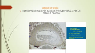 ESTA REPRESENTADO POR EL DISCO INTERVERTEBRAL Y POR UN
ESTUCHE FIBROSO.
FIG.16 DISCO
INTERVERTEBRAL
VISTA SUPERIOR
NP: NÚCLEO PULPOSO.
AF: ANILLOS FIBROSOS.
MODIFICADO DE FINN GENESSER “
HISTOLOGÍA”
 