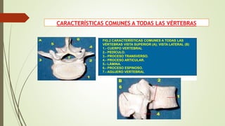 CARACTERÍSTICAS COMUNES A TODAS LAS VÉRTEBRAS
FIG.2 CARACTERÍSTICAS COMUNES A TODAS LAS
VÉRTEBRAS VISTA SUPERIOR (A); VISTA LATERAL (B)
1.- CUERPO VERTEBRAL
2.- PEDÍCULO.
3.- PROCESO TRANSVERSO.
4.- PROCESO ARTICULAR.
5.- LÁMINA.
6.- PROCESO ESPINOSO.
7.- AGUJERO VERTEBRAL
 