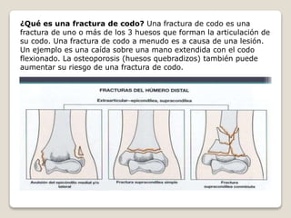 ¿Qué es una fractura de codo? Una fractura de codo es una
fractura de uno o más de los 3 huesos que forman la articulación de
su codo. Una fractura de codo a menudo es a causa de una lesión.
Un ejemplo es una caída sobre una mano extendida con el codo
flexionado. La osteoporosis (huesos quebradizos) también puede
aumentar su riesgo de una fractura de codo.
 