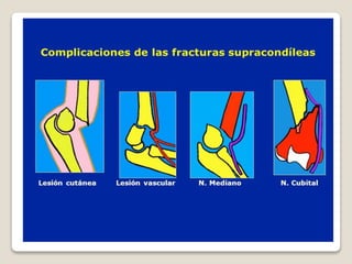 Kinesiologia del codo