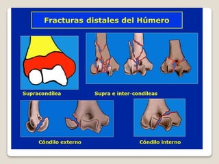 Kinesiologia del codo