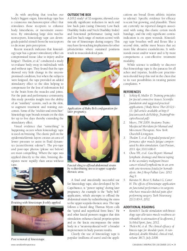 The Evolution of Kinesiology Tape