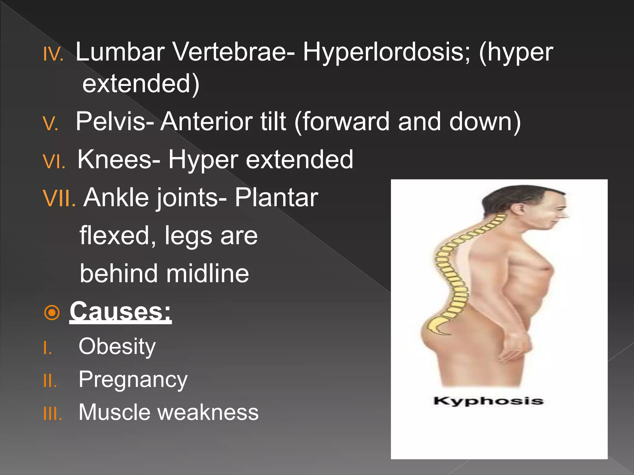 Hypertonic Rigid Posture Kinesiology Postures and its types | PPTX