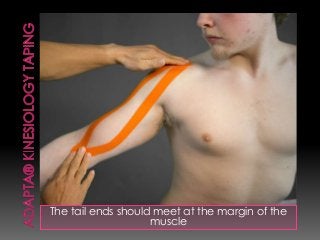 The tail ends should meet at the margin of the
muscle
 