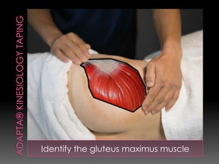 Identify the gluteus maximus muscle
 