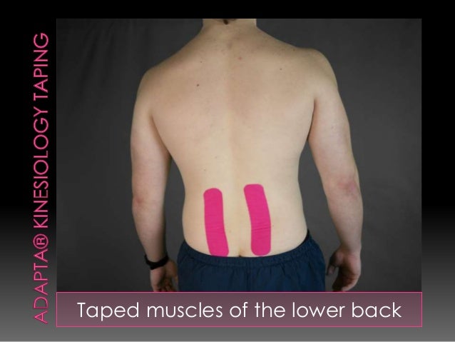 Kinesiology taping lower_back