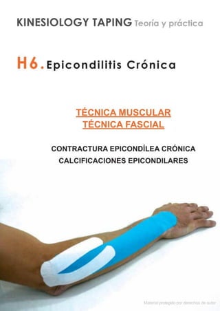Kinesiotape